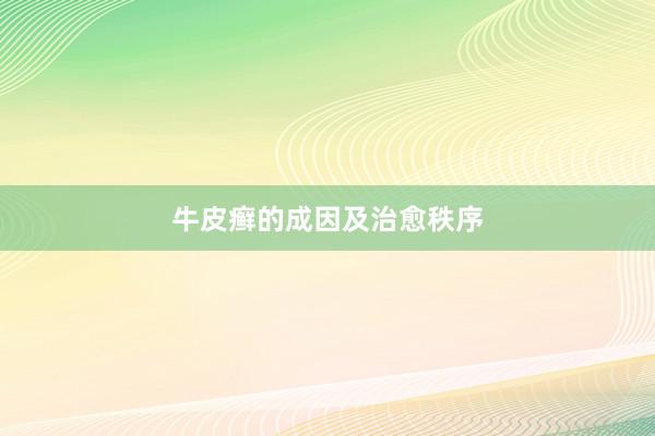 牛皮癣的成因及治愈秩序